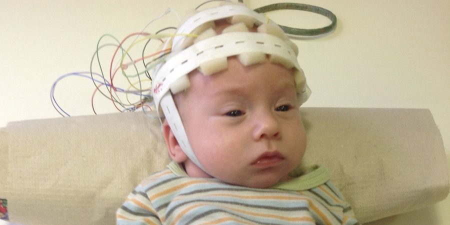 gyermekkori EEG