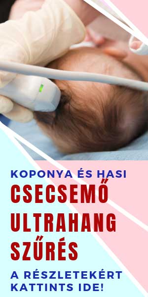 csecsemő ultrahang szűrés
