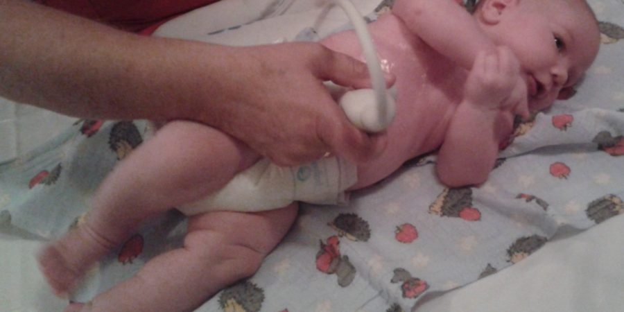 újszülöttkori hasi ultrahang vizsgálat