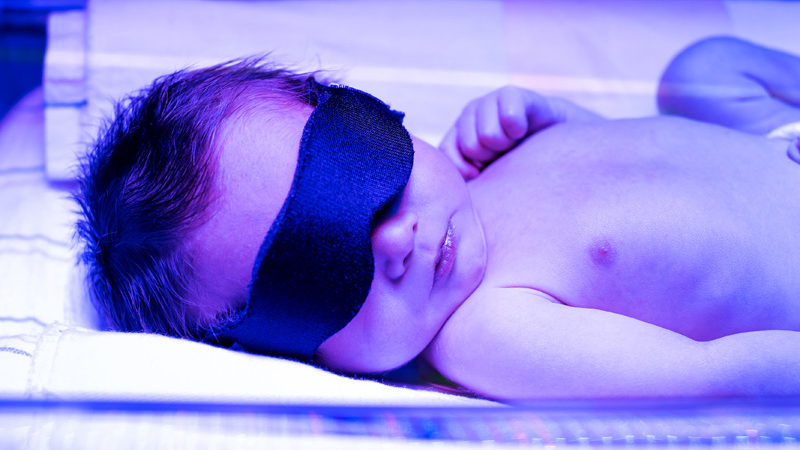kékfénykezelés újszülöttkori sárgaság esetén