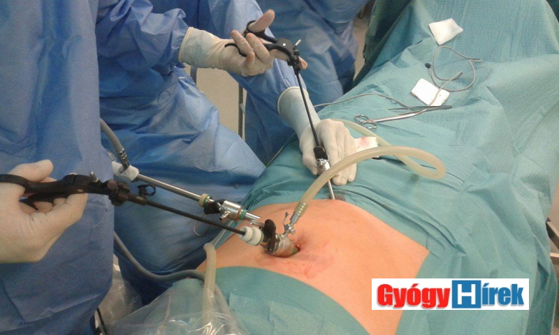 laparoszkópos veseműtét)