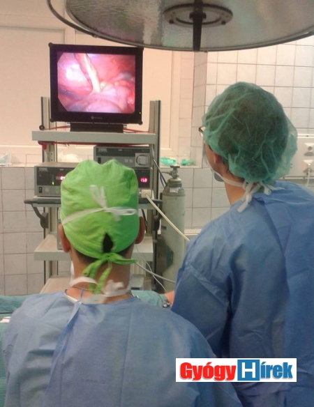 laparoscopos műtét 2. ábra