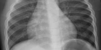 röntgenfelvételek