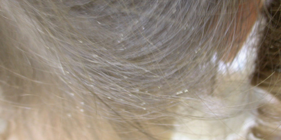 Rovarok és élősködők okozta bőrbetegségek - Paraziták a fej kezelése