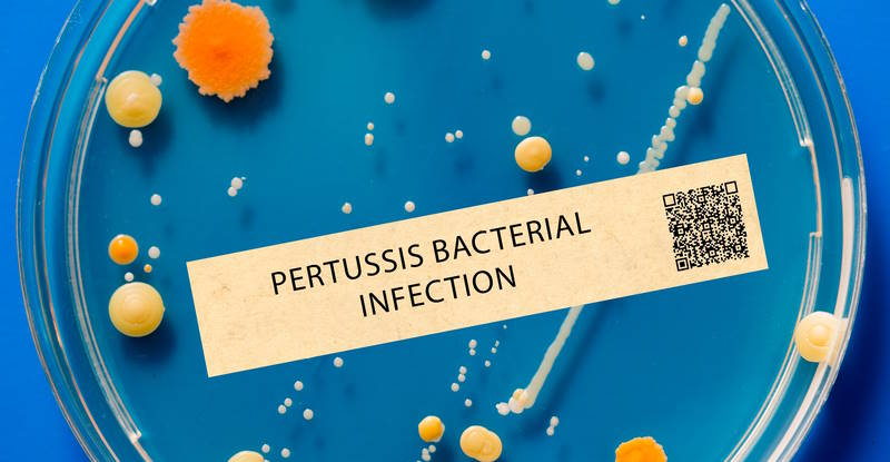 pertussis bacerial infection