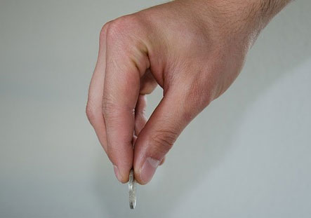 hogyan lehet enyhíteni az duzzanatot az ujjak artritiszével