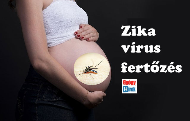 Zika-vírus fertőzés illusztráció